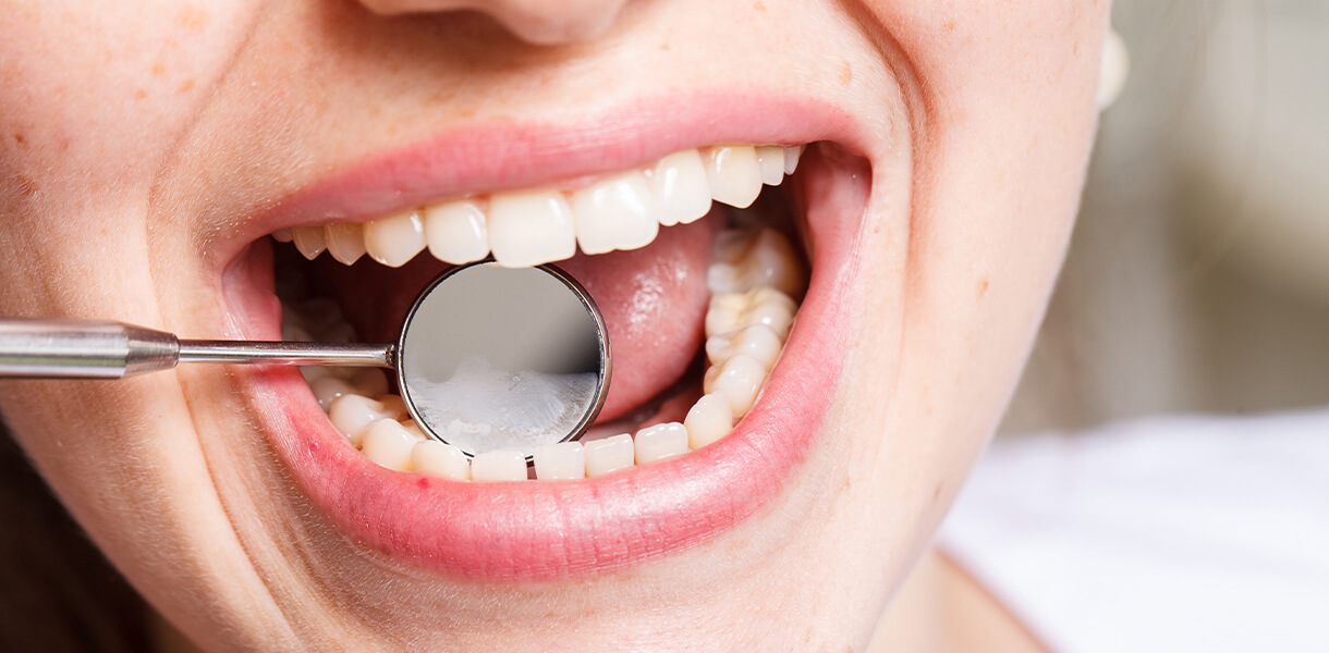 Dental Excellence gum recession treatment in Independence
