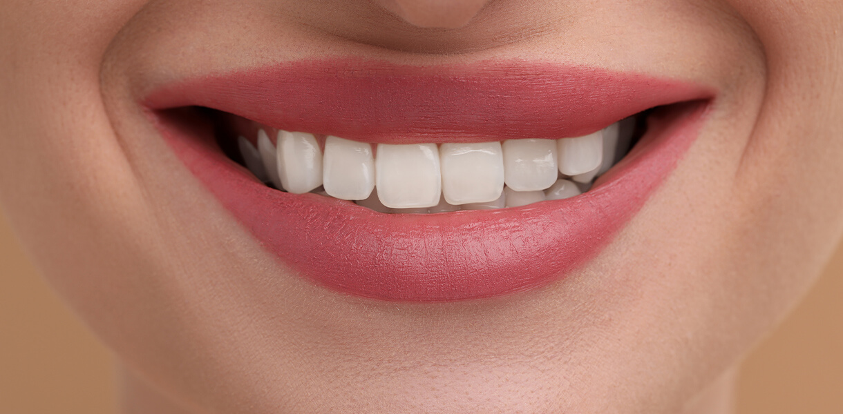 hdr_Services_Cos_Bonding cosmetic dental bonding in Independence MO