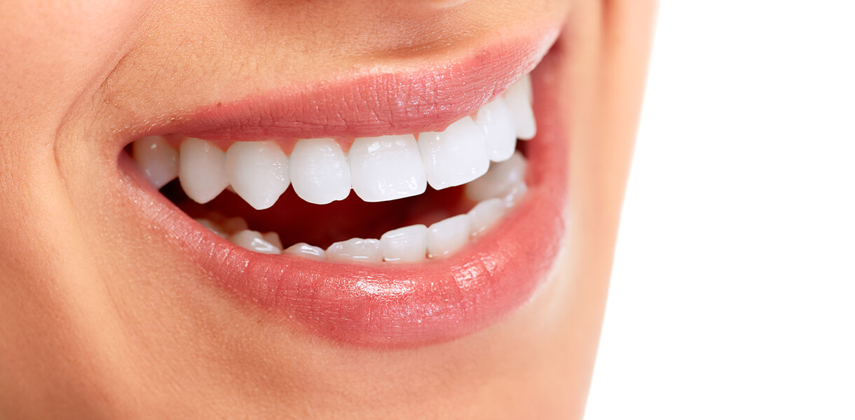 hdr_Services_Cosmetic cosmetic dentistry in independence mo beautiful smile